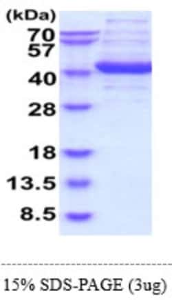 Novus Biologicals&trade;&nbsp;Recombinant Human Aldolase C Protein
